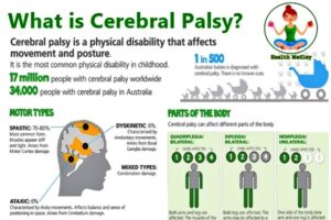 Cerebral Palsy Meaning, Types, Causes, Treatment, Disability in Adults, Baby Feet