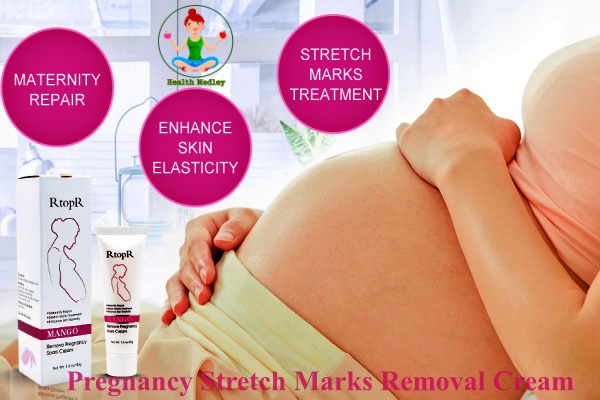 6 Best Creams to Remove Pregnancy Stretch Marks Permanently at Home